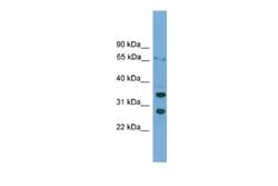 D Box Binding Protein Rabbit anti-Human, Polyclonal, Novus Biologicals 0.1 mL | Buy Online | Novus Biologicals | Fisher Scientific